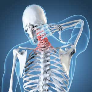 bad posture can cause neck pain