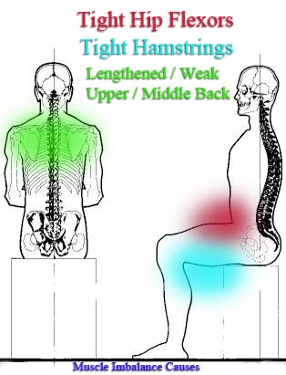 seated posture problems