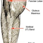 IT Band Syndrome Prevention and Treatment for Runners and Cyclists IT Band Syndrome Prevention and Treatment for Runners and Cyclists