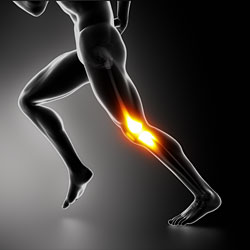 All About Iliotibial / IT Band Friction Syndrome All About Iliotibial / IT Band Friction Syndrome