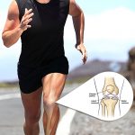 Injuries to the Meniscus: What You Need to Know Injuries to the Meniscus: What You Need to Know