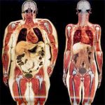 Subcutaneous Fat vs. Visceral Fat & NAFLD Subcutaneous Fat vs. Visceral Fat & NAFLD