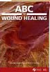 ABC Wound Healing