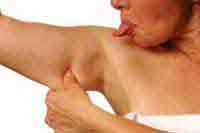 woman with flabby arms