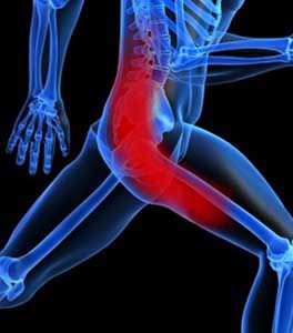 Sciatica & Piriformis Syndrome