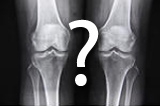 knee xray?