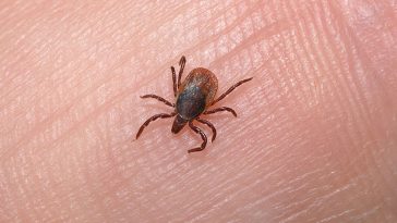5 Signs You Might Have Parasites