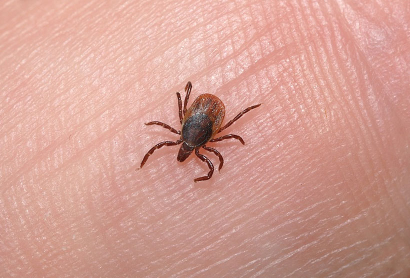 5 Signs You Might Have Parasites