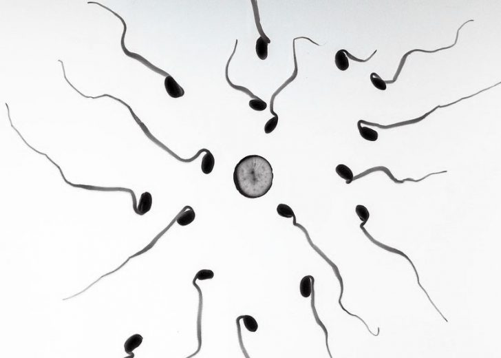 Boxers vs Briefs What is Best for Men's Fertility?