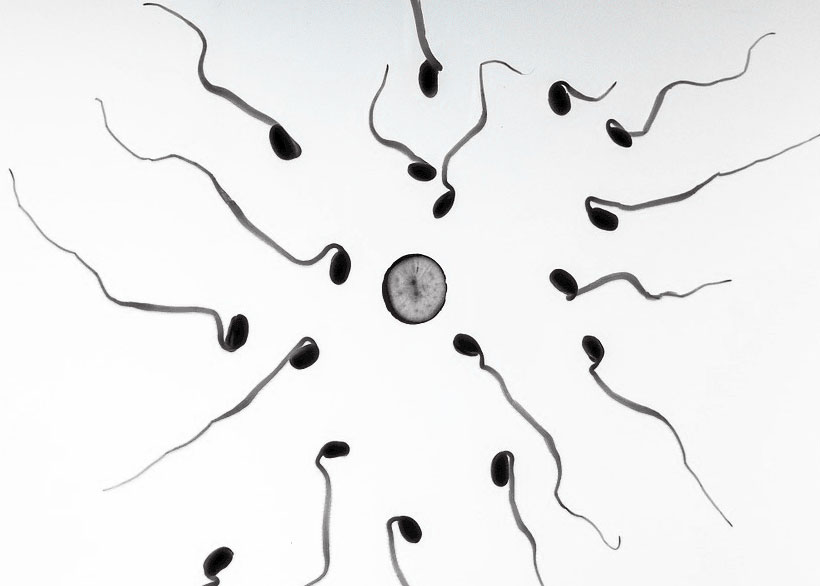 Boxers vs Briefs Best for Men's Fertility