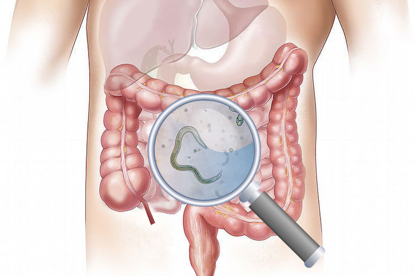 Benefits of Human Parasite Cleansing