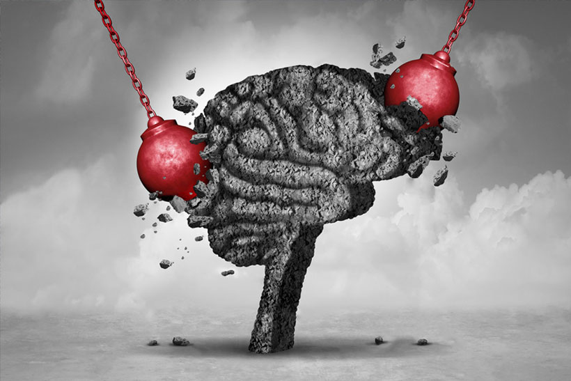 concussion of the brain