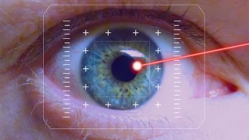 lasik eye procedure