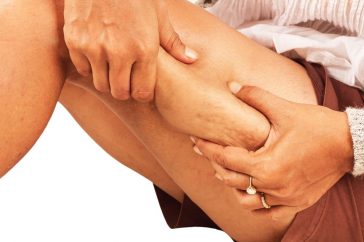 how to reduce thigh fat