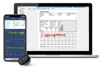 Wellue O2 Ring review