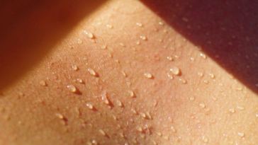 skin sweating