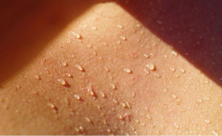 skin sweating
