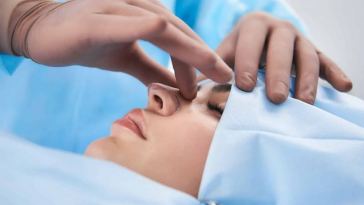 rhinoplasty