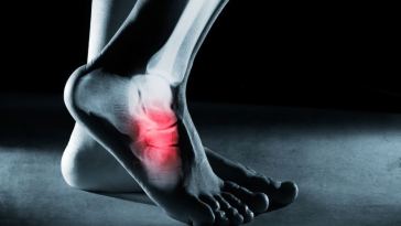 foot surgery