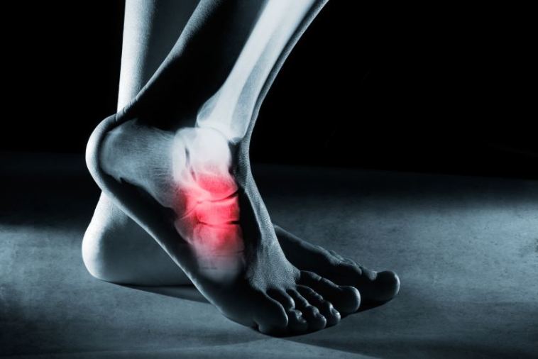 foot surgery
