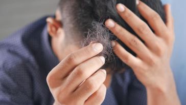hair loss