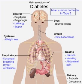 diabetes symptoms