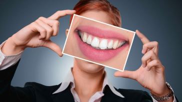 Veneers vs. Lumineers