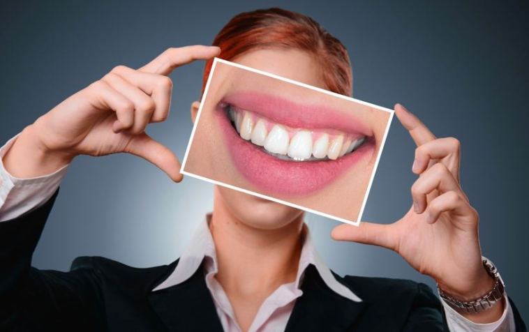 Veneers vs. Lumineers