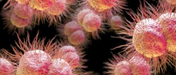 gonorrhea