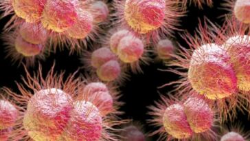gonorrhea