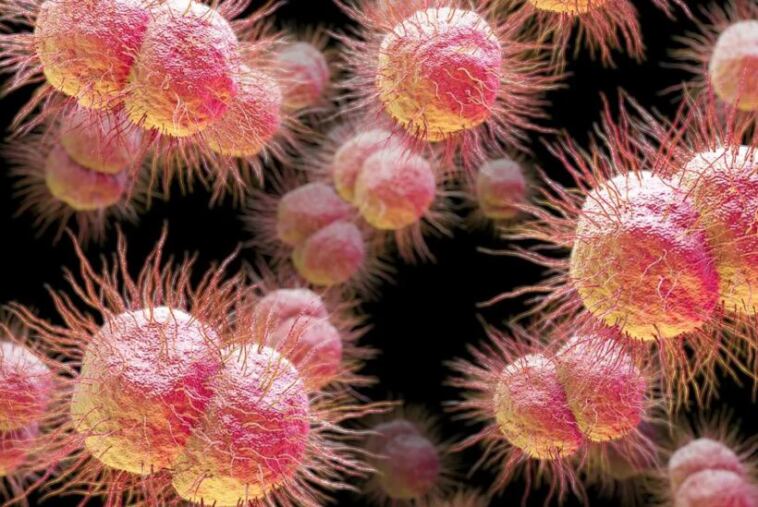 gonorrhea