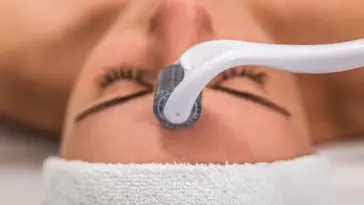 microneedling benefits for your skin