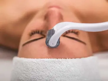 microneedling benefits for your skin