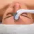 microneedling benefits for your skin
